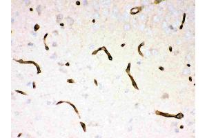 Immunohistochemistry (IHC) image for anti-Dystrophin (DMD) (AA 3076-3404) antibody (ABIN3043317)