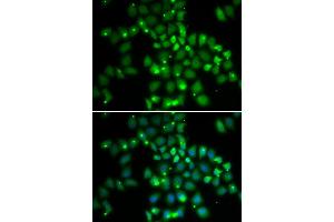 Immunofluorescence analysis of HeLa cells using PCGF6 antibody. (PCGF6 抗体)
