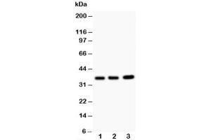 Western blot testing of TNFAIP1 antibody and Lane 1:  rat thymus