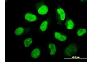 Image no. 4 for anti-Eukaryotic Translation Initiation Factor 2-alpha Kinase 2 (EIF2AK2) (AA 1-101) antibody (ABIN598901) (EIF2AK2 抗体  (AA 1-101))