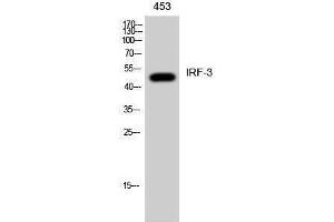 Western Blotting (WB) image for anti-Interferon Regulatory Factor 3 (IRF3) (Ser605) antibody (ABIN3185227) (IRF3 抗体  (Ser605))