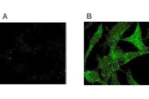 Immunocytochemistry showing the detection of Tollip in Tollip -/- (A) or overexpressed Tollip in -/- (B) murine embryonic fibroblasts (MEF) cells with the MAb to Tollip (Kimmy-2) . (TOLLIP 抗体  (AA 1-274))