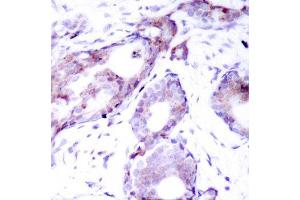Immunohistochemistry (IHC) image for anti-Myc Proto-Oncogene protein (MYC) (pSer373) antibody (ABIN3019599) (c-MYC 抗体  (pSer373))