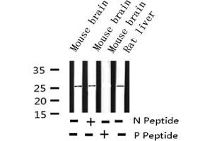 Western blot analysis of Phospho-eIF4E (Ser209) expression in various lysates (EIF4E 抗体  (pSer209))