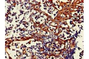 Immunohistochemistry of paraffin-embedded human tonsil tissue using ABIN7160758 at dilution of 1:100 (FPR3 抗体  (AA 307-353))
