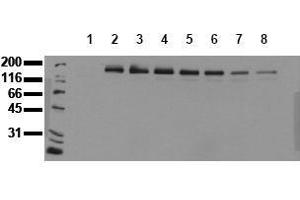 Western Blotting (WB) image for anti-Receptor tyrosine-protein kinase erbB-2 (ErbB2/Her2) (pTyr1248) antibody (ABIN126792) (ErbB2/Her2 抗体  (pTyr1248))