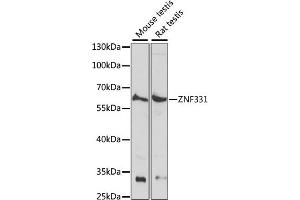 Western blot analysis of extracts of various cell lines, using ZNF331 antibody (ABIN7271477) at 1:1000 dilution. (ZNF331 抗体  (AA 50-130))