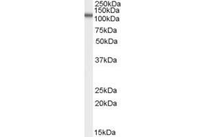 Western Blotting (WB) image for anti-Family with Sequence Similarity 188, Member A (FAM188A) (N-Term) antibody (ABIN2789239) (FAM188A 抗体  (N-Term))