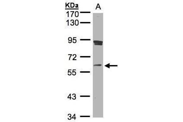SCMH1 anticorps  (Center)