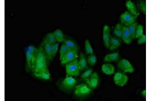 Immunofluorescent analysis of HepG2 cells using ABIN7173317 at dilution of 1:100 and Alexa Fluor 488-congugated AffiniPure Goat Anti-Rabbit IgG(H+L) (Transportin 3 抗体  (AA 382-458))