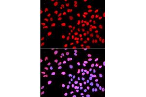 Immunofluorescence analysis of U2OS cells using IKZF1 antibody. (IKZF1 抗体)