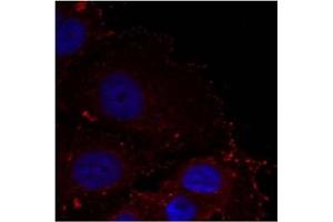 Image no. 1 for anti-Paxillin (PXN) (pTyr88) antibody (ABIN401593) (Paxillin 抗体  (pTyr88))