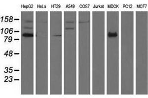 Western blot analysis of extracts (35 µg) from 9 different cell lines by using anti-ALDH1L1 monoclonal antibody. (ALDH1L1 抗体)