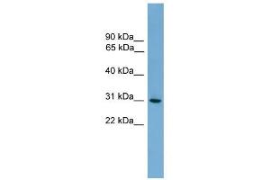 HLA-DQA2 antibody used at 1 ug/ml to detect target protein. (HLA-DQA2 抗体  (N-Term))