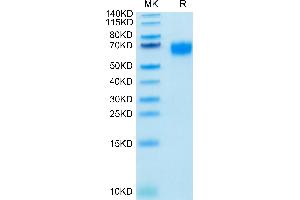 Biotinylated Human IL-2 R gamma on Tris-Bis PAGE under reduced condition. (IL2RG Protein (AA 23-254) (His-Avi Tag,Biotin))