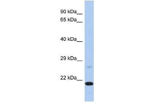 Western Blotting (WB) image for anti-Protoporphyrinogen Oxidase (PPOX) (C-Term) antibody (ABIN2786510) (PPOX 抗体  (C-Term))