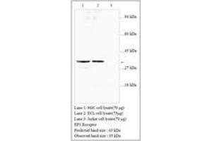 Image no. 1 for anti-Prostaglandin E Receptor 3 (Subtype EP3) (PTGER3) antibody (ABIN791349)