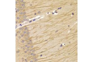 Immunohistochemistry of paraffin-embedded Mouse brain using TCN2 antibody at dilution of 1:100 (x400 lens). (TCN2 抗体)