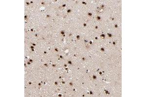 Immunohistochemical staining of human cerebral cortex with RBM22 polyclonal antibody  shows strong nuclear positivity in neuronal cells at 1:20-1:50 dilution.