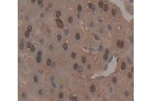 Used in DAB staining on fromalin fixed paraffin- embedded Kidney tissue (PLCB3 抗体  (AA 318-468))