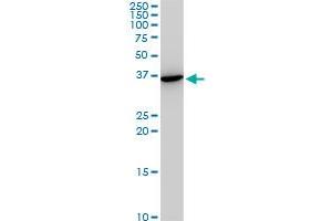 SNAI2 monoclonal antibody (M05), clone 3C12. (SLUG 抗体  (AA 97-169))