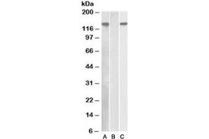 Western blot of HEK293 lysate overexpressing human NLRP2 with DYKDDDDK tag probed with NALP2 antibody [1ug/ml] in Lane A and probed with anti-DYKDDDDK tag [1/1000] in lane C. (NLRP2 抗体)