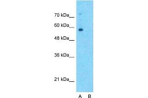 Western Blotting (WB) image for anti-Solute Carrier Family 6 (Neurotransmitter Transporter, Noradrenalin), Member 2 (SLC6A2) (Middle Region) antibody (ABIN2777051)