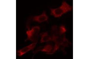 ABIN6266813 staining Hela cells by IF/ICC.