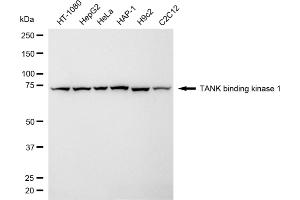 Western blotting analysis using TANK binding kinase 1 antibody (ABIN7800506). (Recombinant TBK1 抗体)