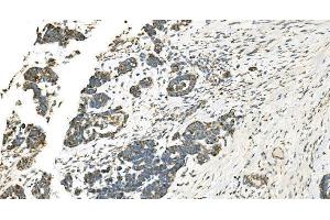 IHC analysis of IDH2 using anti-IDH2 antibody (ABIN7602787). (IDH2 抗体  (C-Term))