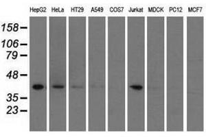 Image no. 3 for anti-3-hydroxyisobutyryl-CoA Hydrolase (HIBCH) antibody (ABIN1498656) (HIBCH 抗体)