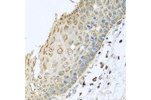 Immunohistochemistry of paraffin-embedded human esophagus using ARFGAP3 antibody at dilution of 1:100 (x40 lens). (ARFGAP3 抗体)