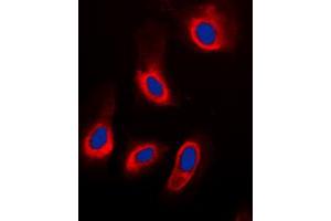 Immunofluorescent analysis of ADPGK staining in HeLa cells. (ADPGK 抗体  (Center))