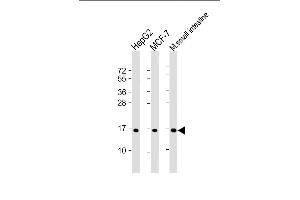 All lanes : Anti-COXIV Isoform 2 Antibody at 1:2000 dilution Lane 1: HepG2 whole cell lysate Lane 2: MCF-7 whole cell lysate Lane 3: mouse small intestine lysate Lysates/proteins at 20 μg per lane. (COX IV 抗体  (Isoform 2))