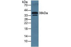 Figure. (DKK3 抗体  (AA 23-349))