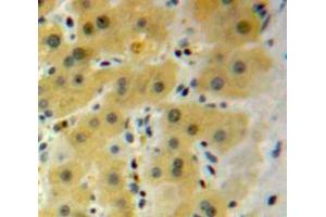 Used in DAB staining on fromalin fixed paraffin-embedded Liver tissue (HSPB2 抗体  (AA 12-170))