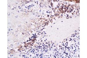 Formalin-fixed and paraffin embedded Human oral mucosa labeled with Anti-IL-6(human) Polyclonal Antibody, Unconjugated  at 1:200, followed by conjugation to the secondary antibody and DAB staining (IL-6 抗体  (AA 26-50))