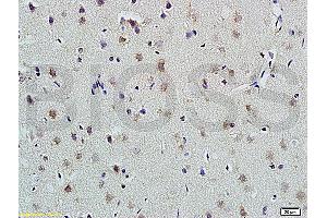 Formalin-fixed and paraffin embedded rat brain labeled with Anti-PLAUR Polyclonal Antibody, Unconjugated (ABIN675443) at 1:200 followed by conjugation to the secondary antibody and DAB staining (PLAUR 抗体  (AA 201-300))