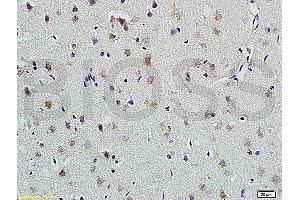 Formalin-fixed and paraffin embedded rat brain labeled with Anti-PLAUR Polyclonal Antibody, Unconjugated (ABIN675443) at 1:200 followed by conjugation to the secondary antibody and DAB staining (PLAUR 抗体  (AA 201-300))