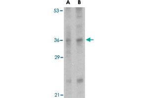 Western blot analysis of IL33 in human lymph node tissue lysate with IL33 polyclonal antibody  at (A) 1 and (B) 2 ug/mL .