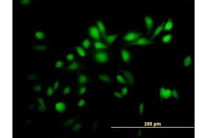 Immunofluorescence of purified MaxPab antibody to TRIM39 on HeLa cell. (TRIM39 抗体  (AA 1-488))