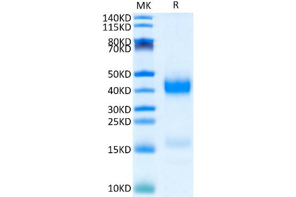 Azurocidin Protein (His tag)