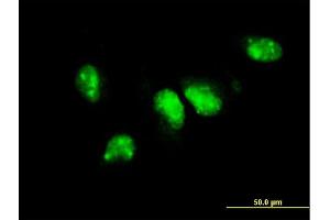 Immunofluorescence of monoclonal antibody to PIM1 on HeLa cell. (PIM1 抗体  (AA 1-100))