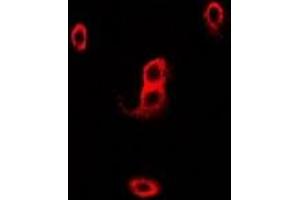 Immunofluorescent analysis of p67 phox staining in Hela cells. (NCF2 抗体)