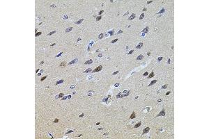 Immunohistochemistry of paraffin-embedded rat brain using PLK4 antibody. (PLK4 抗体)