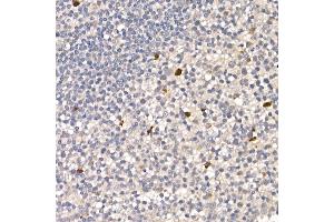 Immunohistochemistry of paraffin-embedded human tonsil using NUR77 Rabbit pAb (ABIN6132395, ABIN6144826, ABIN6144829 and ABIN6222380) at dilution of 1:100 (40x lens). (NR4A1 抗体  (AA 1-170))