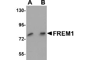 Western Blotting (WB) image for anti-FRAS1 Related Extracellular Matrix 1 (FREM1) (C-Term) antibody (ABIN1030402) (FREM1 抗体  (C-Term))