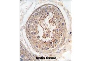 Formalin-fixed and raffin-embedded human testis tissue reacted with SG9 antibody (Center) (ABIN391447 and ABIN2841430) , which was peroxidase-conjugated to the secondary antibody, followed by DAB staining. (SPAG9 抗体  (AA 603-632))