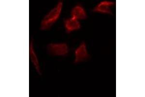 Immunofluorescence (fixed cells) (IF/ICC) image for anti-Glial Fibrillary Acidic Protein (GFAP) (pSer38) antibody (ABIN6256306)