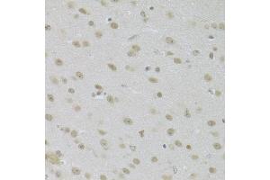 Immunohistochemistry of paraffin-embedded mouse brain using JMJD6 Antibody (ABIN5973452) at dilution of 1/100 (40x lens). (JMJD6 抗体)